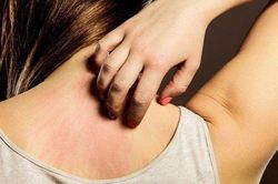 Trước khi ung thư ập đến, trên cơ thể sẽ có 2 cơn ngứa: Phát hiện sớm có thể giúp bạn cứu sống chính mình
