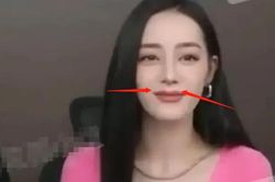Cảm thấy mình vẫn chưa đủ đẹp, Địch Lệ Nhiệt Ba quyết định bơm môi?