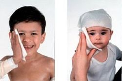 Hướng dẫn quấn băng ướt trong điều trị cho trẻ bị eczema