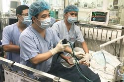 Sặc hạt điều, bé trai 2 tuổi nguy kịch tính mạng