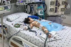 TP. HCM: Cứu bé gái 15 tháng tuổi mắc bệnh chân tay miệng biến chứng nặng