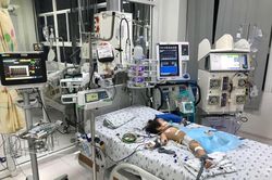 Cứu sống bé gái trụy tim, nguy kịch vì biến chứng tay chân miệng