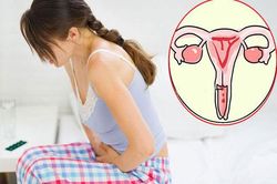 Người phụ nữ khỏi hoàn toàn ung thư cổ tử cung nhờ việc làm đặc biệt quan trọng này