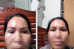 Thẩm mỹ viện 'chui' hoạt động công khai