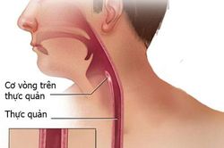 Dấu hiệu dễ thấy của ung thư thực quản