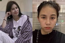 Diễn viên Trần Tiểu Lôi phát hiện bị u não