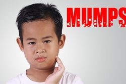 Tổng hợp những điều cha mẹ cần biết khi chăm sóc trẻ bị quai bị tại nhà