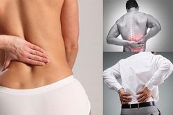 Đau lưng là dấu hiệu của bệnh gì?