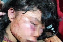 Phút hãi hùng của nữ sinh lớp 6 bị hành hung bên rừng cao su