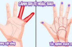 Dấu hiệu bàn tay cảnh báo căn bệnh vô cùng nguy hiểm rất nhiều người Việt vẫn cố tình bỏ qua