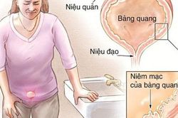 5 dấu hiệu 'lạ' xuất hiện khi đi vệ sinh cảnh báo căn bệnh nguy hiểm, hãy đi khám ngay còn kịp