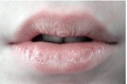 4 dấu hiệu trên khuôn mặt cảnh báo gan của bạn đang 'kêu cứu'
