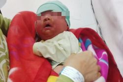 Tắm bằng nước lá cây, bé 20 ngày tuổi bị nhiễm độc nặng