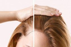Mẹo giúp tóc mỏng trở nên dày chỉ trong tức khắc