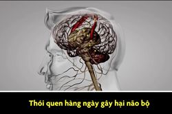 Thói quen hàng ngày gây hại não bộ mà bạn không biết