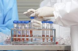 Hà Nội: Ca nghi nhiễm Covid-19 ở Thanh Oai đã âm tính với SARS-CoV-2