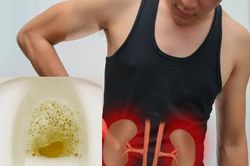 4 dấu hiệu cảnh báo suy thận bạn cần nắm rõ