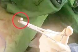Thông tin mới nhất vụ bị bắn thủng bụng lúc 2 giờ sáng
