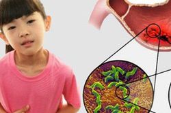 Con thủng dạ dày, tá tràng vì thói quen khi ăn của triệu gia đình Việt