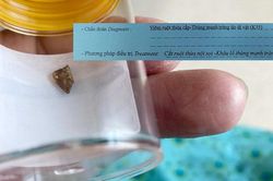 Kịp thời xử lý ca viêm ruột thừa cấp, nhưng không có triệu chứng