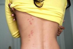 Top 8 dấu hiệu cảnh báo bạn đang bị stress nặng