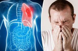 Thấy 5 dấu hiệu này, hãy cảnh giác vì phổi đang 'tích độc', nhanh chân đi khám ngay