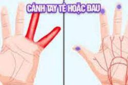 Dấu hiệu bàn tay cảnh báo căn bệnh vô cùng nguy hiểm rất nhiều người Việt vẫn cố tình bỏ qua