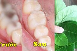 Trị dứt điểm sâu răng, viêm lợi, hôi miệng bằng loại lá rẻ bèo vườn nào cũng có, chợ nào cũng bán