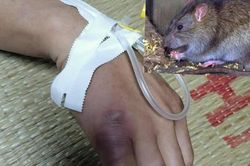 Người đàn ông ở Cao Bằng nổi hạch khắp người sau khi bị chuột cắn