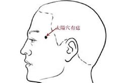 Có 1 trong 6 nốt ruồi ở vị trí này, cả đời sung túc