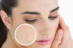 Nếu thấy da khô cần thay đổi ngay thói quen này