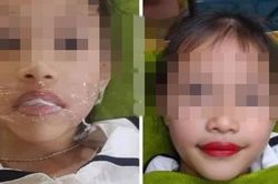 Lộ danh tính người phun môi cho bé gái 5 tuổi, biết sự thật dư luận càng phẫn nộ