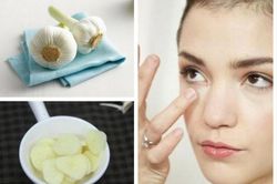 Hết ngay mụn thịt chỉ với 1 củ tỏi