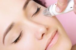 Tẩy nốt ruồi liệu có bị mọc lại?