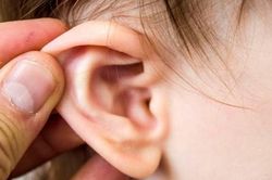 Cách lấy ráy tai cực kì nguy hiểm mà nhiều người vẫn hay làm