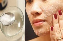 3 cách trị sẹo thâm tại nhà bạn cần ghi nhớ