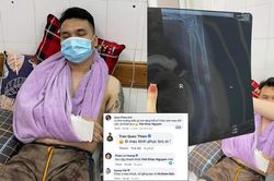 Khắc Việt gãy cổ tay phải hủy hàng loạt show diễn, nhiều nghệ sĩ gửi lời động viên