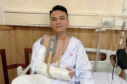 Sau sự cố gãy xương cổ tay, ca sĩ Khắc Việt thông báo đã phẫu thuật thành công