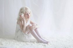 Vẻ đẹp thuần khiết, như bước ra từ cổ tích của người bạch tạng