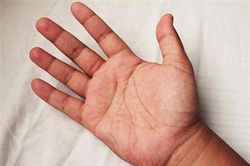 '1 lồi, 2 đỏ, 2 đau'' cảnh báo ung thư gan: Dấu hiệu không thể nhầm, đi khám ngay còn kịp