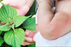 6 loại lá tắm trị rôm sảy, mẩn ngứa cực kỳ hiệu quả, mẹ cần biết ngay