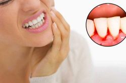 Cảnh báo nguy hiểm khi thường xuyên chảy máu chân răng