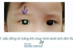 Cẩn trọng với bệnh ung thư nguyên bào võng mạc ở trẻ em
