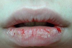 Dấu hiệu bất thường ở cơ thể cần chú ý