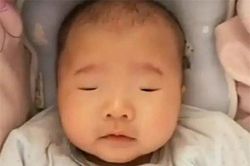 Sau sinh 9 ngày mắt con vẫn không mở, mẹ sợ hãi đi khám nhưng bác sĩ lại bật cười