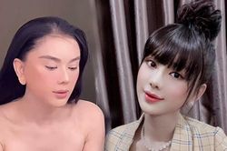 Lâm Khánh Chi lộ trán hói, tóc thưa thớt phải dùng mái giả để che chắn