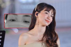 Xuất hiện với đôi mắt sưng húp: Chuyện gì xảy ra với Hòa Minzy thế này?