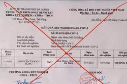 Đưa kết quả xét nghiệm SARS-CoV-2 giả lên mạng xã hội