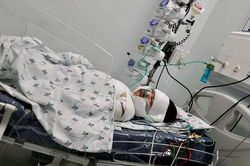 Bé gái bị bỏng nặng cần được giúp đỡ