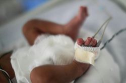 Nhầm lẫn khi siêu âm, sản phụ 25 tuổi sinh 9 đứa trẻ